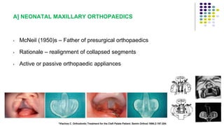 A] NEONATAL MAXILLARY ORTHOPAEDICS
• McNeil (1950)s – Father of presurgical orthopaedics
• Rationale – realignment of collapsed segments
• Active or passive orthopaedic appliances
110
*Vlachos C. Orthodontic Treatment for the Cleft Palate Patient. Semin Orthod 1996;2:197-204.
 