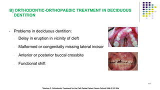 B] ORTHODONTIC-ORTHOPAEDIC TREATMENT IN DECIDUOUS
DENTITION
• Problems in deciduous dentition:
- Delay in eruption in vicinity of cleft
- Malformed or congenitally missing lateral incisor
- Anterior or posterior buccal crossbite
- Functional shift
111
*Vlachos C. Orthodontic Treatment for the Cleft Palate Patient. Semin Orthod 1996;2:197-204
 