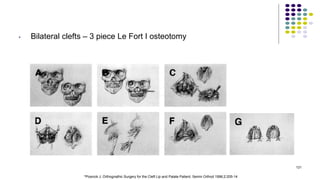 • Bilateral clefts – 3 piece Le Fort I osteotomy
121
*Posnick J. Orthognathic Surgery for the Cleft Lip and Palate Patient. Semin Orthod 1996;2:205-14
 