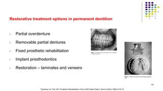 Restorative treatment options in permanent dentition
• Partial overdenture
• Removable partial dentures
• Fixed prosthetic rehabilitation
• Implant prosthodontics
• Restoration – laminates and veneers
124
*Gardener LK, Parr GR. Prosthetic Rehabilitation of the Cleft Palate Patient. Semin Orthod 1996;2:215-19
 