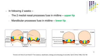 • In following 2 weeks –
• The 2 medial nasal processes fuse in midline – upper lip
• Mandibular processes fuse in midline – lower lip
13
Thronton JB, Nimer S and Howrd P. The incidence, classification, etiology and embryology of oral clefts. Semin Orthod 1996;2:162-168
 