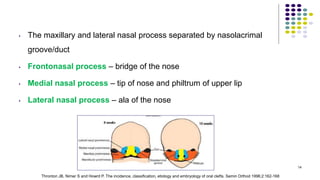 • The maxillary and lateral nasal process separated by nasolacrimal
groove/duct
• Frontonasal process – bridge of the nose
• Medial nasal process – tip of nose and philtrum of upper lip
• Lateral nasal process – ala of the nose
14
Thronton JB, Nimer S and Howrd P. The incidence, classification, etiology and embryology of oral clefts. Semin Orthod 1996;2:162-168
 