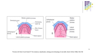 16
Thronton JB, Nimer S and Howrd P. The incidence, classification, etiology and embryology of oral clefts. Semin Orthod 1996;2:162-168
 