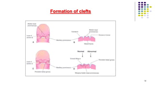 Formation of clefts
19
 