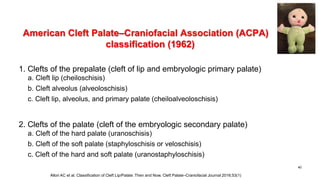 American Cleft Palate–Craniofacial Association (ACPA)
classification (1962)
1. Clefts of the prepalate (cleft of lip and embryologic primary palate)
a. Cleft lip (cheiloschisis)
b. Cleft alveolus (alveoloschisis)
c. Cleft lip, alveolus, and primary palate (cheiloalveoloschisis)
2. Clefts of the palate (cleft of the embryologic secondary palate)
a. Cleft of the hard palate (uranoschisis)
b. Cleft of the soft palate (staphyloschisis or veloschisis)
c. Cleft of the hard and soft palate (uranostaphyloschisis)
40
Allori AC et al. Classification of Cleft Lip/Palate: Then and Now. Cleft Palate–Craniofacial Journal 2016;53(1)
 