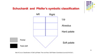 Schuchardt and Pfeifer’s symbolic classification
left Right
Lip
Alveolus
Hard palate
Soft palate
Total cleft
Partial
45
Allori AC et al. Classification of Cleft Lip/Palate: Then and Now. Cleft Palate–Craniofacial Journal 2016;53(1)
 