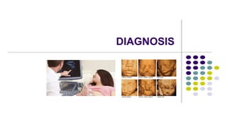 DIAGNOSIS
 