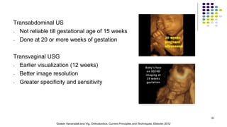 Transabdominal US
- Not reliable till gestational age of 15 weeks
- Done at 20 or more weeks of gestation
Transvaginal USG
- Earlier visualization (12 weeks)
- Better image resolution
- Greater specificity and sensitivity
50
Graber Vanarsdall and Vig. Orthodontics: Current Principles and Techniques. Elsevier 2012
 