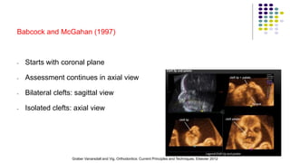 Babcock and McGahan (1997)
- Starts with coronal plane
- Assessment continues in axial view
- Bilateral clefts: sagittal view
- Isolated clefts: axial view
51
Graber Vanarsdall and Vig. Orthodontics: Current Principles and Techniques. Elsevier 2012
 