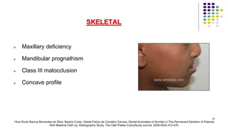 57
SKELETAL
 Maxillary deficiency
 Mandibular prognathism
 Class III malocclusion
 Concave profile
*Ana Paula Ramos Bernardes da Silva, Beatriz Costa, Cleide Felício de Carvalho Carrara, Dental Anomalies of Number in The Permanent Dentition of Patients
With Bilateral Cleft Lip: Radiographic Study, The Cleft Palate-Craniofacial Journal. 2008;45(5):473-476.
 