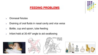 58
FEEDING PROBLEMS
 Oronasal fistulas
 Draining of oral fluids in nasal cavity and vice versa
 Bottle, cup and spoon, tube feeding
 Infant held at 30-450 angle to aid swallowing
 
