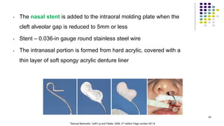 • The nasal stent is added to the intraoral molding plate when the
cleft alveolar gap is reduced to 5mm or less
• Stent – 0.036-in gauge round stainless steel wire
• The intranasal portion is formed from hard acrylic, covered with a
thin layer of soft spongy acrylic denture liner
83
*Samuel Berkowitz. Celft Lip and Palate. 2006. 2nd edition Page number 451-8.
 