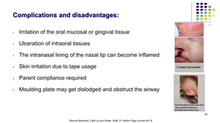 86
Complications and disadvantages:
• Irritation of the oral mucosal or gingival tissue
• Ulceration of intraoral tissues
• The intranasal lining of the nasal tip can become inflamed
• Skin irritation due to tape usage
• Parent compliance required
• Moulding plate may get dislodged and obstruct the airway
*Samuel Berkowitz. Celft Lip and Palate. 2006. 2nd edition Page number 451-8.
 