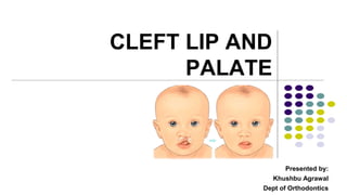 CLEFT LIP AND
PALATE
Presented by:
Khushbu Agrawal
Dept of Orthodontics
 