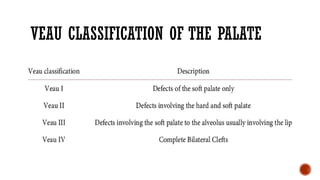Veau Classfication Comprehensive Overview of Cleft Lip and Palate: Embryology, Anatomy ...
