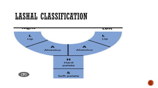 Lahsal Classification Examples Comprehensive Overview of Cleft Lip and Palate: Embryology, Anatomy ...