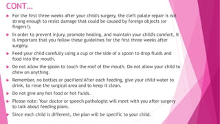 Cleft lip and palatre | PPTX