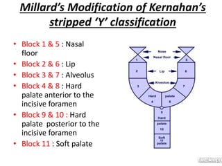 Millard’s Modification of Kernahan’s
stripped ‘Y’ classification
• Block 1 & 5 : Nasal
floor
• Block 2 & 6 : Lip
• Block 3 & 7 : Alveolus
• Block 4 & 8 : Hard
palate anterior to the
incisive foramen
• Block 9 & 10 : Hard
palate posterior to the
incisive foramen
• Block 11 : Soft palate
 