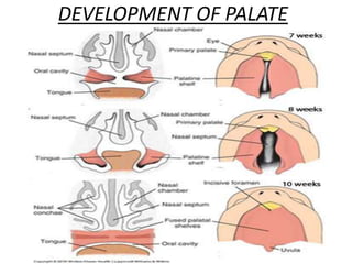 DEVELOPMENT OF PALATE
 