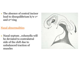 cleft lip FINAL.ppt