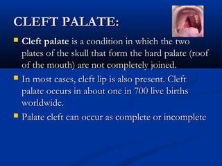 CLEFT PALATE:
   Cleft palate is a condition in which the two
    plates of the skull that form the hard palate (roof
    of the mouth) are not completely joined.
   In most cases, cleft lip is also present. Cleft
    palate occurs in about one in 700 live births
    worldwide.
   Palate cleft can occur as complete or incomplete
 