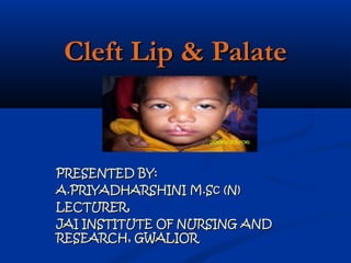 Cleft Lip & Palate


PRESENTED BY:
A.PRIYADHARSHINI M.Sc (N)
LECTURER,
JAI INSTITUTE OF NURSING AND
RESEARCH, GWALIOR
 