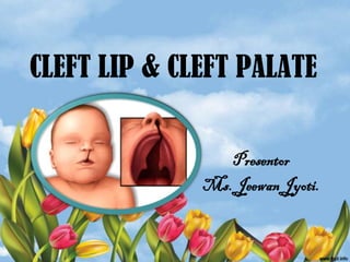 CLEFT LIP & CLEFT PALATE


                 Presentor
              Ms. Jeewan Jyoti.
 