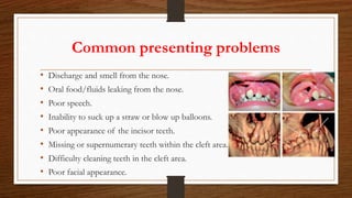 Common presenting problems
• Discharge and smell from the nose.
• Oral food/fluids leaking from the nose.
• Poor speech.
• Inability to suck up a straw or blow up balloons.
• Poor appearance of the incisor teeth.
• Missing or supernumerary teeth within the cleft area.
• Difficulty cleaning teeth in the cleft area.
• Poor facial appearance.
 