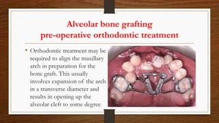 Alveolar bone grafting
pre-operative orthodontic treatment
• Orthodontic treatment may be
required to align the maxillary
arch in preparation for the
bone graft. This usually
involves expansion of the arch
in a transverse diameter and
results in opening up the
alveolar cleft to some degree
 