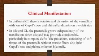 Clinical Manifestation
• In unilateral CL there is rotation and distortion of the vermillion
with loss of Cupid's bow and philtral landmarks on the cleft side
• In bilateral CL, the premaxilla grows independently of the
maxillae on either side and may protrude considerably,
particularly in complete clefts. The prolabium, consisting of soft
tissues of the premaxilla without muscle fibers, also lacks
Cupid's bow and philtral columns bilaterally.
 