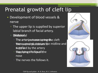 Cleft lip palate | PPTX