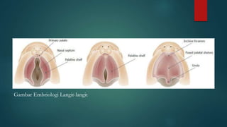 Gambar Embriologi Langit-langit
 