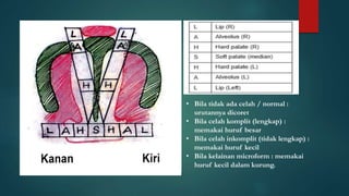 • Bila tidak ada celah / normal :
urutannya dicoret
• Bila celah komplit (lengkap) :
memakai huruf besar
• Bila celah inkomplit (tidak lengkap) :
memakai huruf kecil
• Bila kelainan microform : memakai
huruf kecil dalam kurung.
 