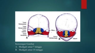 Keterangan Gambar
A. Mudigah umur 7 minggu
B. Mudigah umur 10 minggu
 