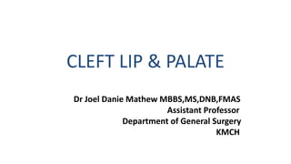 CLEFT LIP & PALATE
Dr Joel Danie Mathew MBBS,MS,DNB,FMAS
Assistant Professor
Department of General Surgery
KMCH
 