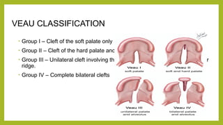 Veau Classfication cleft lip & palate.pptxkokinlkjjoknkjnono | PPTX