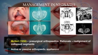 Comprehensive Management of Cleft Lip and Palate: Diagnosis, Treatment ...