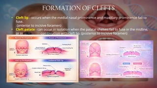 Comprehensive Management of Cleft Lip and Palate: Diagnosis, Treatment ...