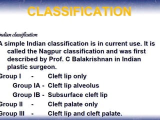 cleft lip palate anatomy embryology types management.pptx
