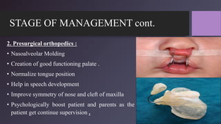 STAGE OF MANAGEMENT cont.
2. Presurgical orthopedics :
• Nasoalveolar Molding
• Creation of good functioning palate .
• Normalize tongue position
• Help in speech development
• Improve symmetry of nose and cleft of maxilla
• Psychologically boost patient and parents as the
patient get continue supervision .
 