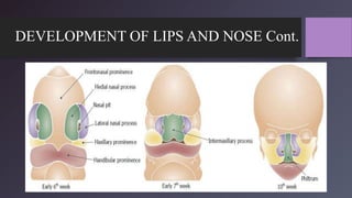 DEVELOPMENT OF LIPS AND NOSE Cont.
 