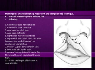 Cleft lip repair | PPTX