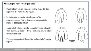 CASE PRESENTATION ON CLEFT LIP Mazhil.pptx