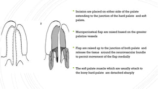 An overview of cleft palate & its management | PPTX