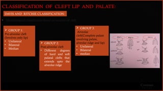 Comprehensive Management of Cleft Palate: Embryology to Prosthodontics ...