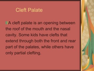 cleft palate4.ppt