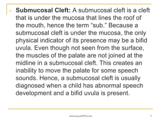 Cleft Palate Lip Bifid uvula submucosal cleft modified by Dr Nayyar.ppt