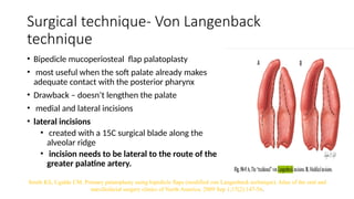 cleft palate embryology and comprehensive cleft care | PPTX