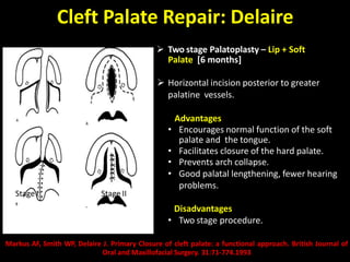 Cleft Palate & It's Management | PPTX