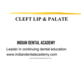 CLEFT LIP & PALATE

INDIAN DENTAL ACADEMY
Leader in continuing dental education
www.indiandentalacademy.com
www.indiandentalacademy.com

 
